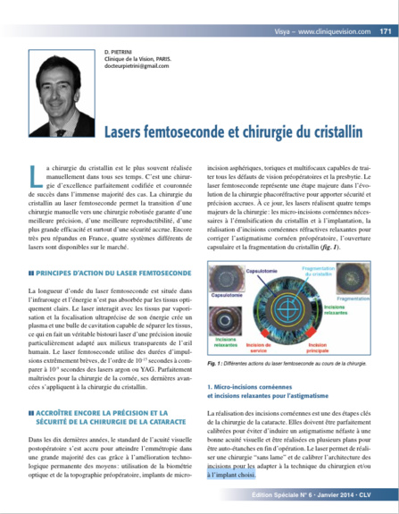 Publication du docteur Pietrini : Lasers Femtoseconde et Chirurgie du Cristallin